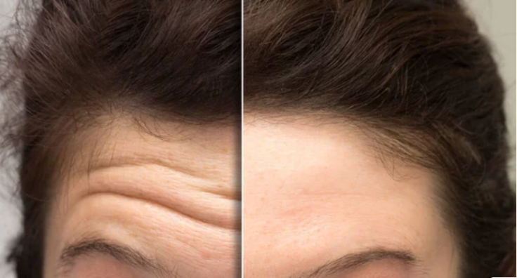 Anti-Wrinkle